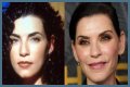 Julianna Margulies Doesn’t Look Natural After Plastic Surgery!